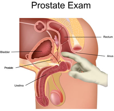 Prostata massage wie