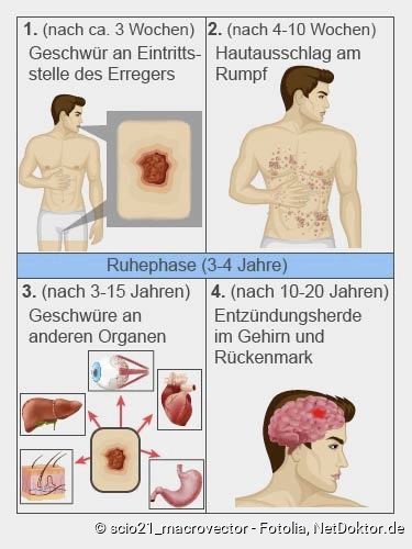 Sperma von mund zu mund