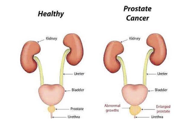 cum compilation Prostate