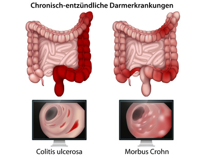 Penis dringt ein